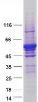 protq8iwu9 tryptophan 5 hydroxylase 2 tph2 human recombinant protein