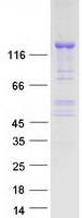 Coomassie blue staining of purified CDAN1 protein