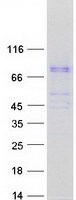 Coomassie blue staining of purified BBS7 protein