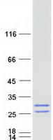 protq8ix19 mcemp1 human recombinant protein