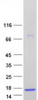 Coomassie blue staining of purified ASXL1 protein