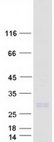 Coomassie blue staining of purified NRM protein