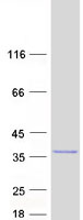 protq8ixp5 c11orf53 human recombinant protein