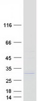 protq8ixq9 etfbkmt human recombinant protein