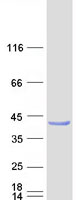 Coomassie blue staining of purified PPIL6 protein