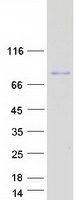 Coomassie blue staining of purified TIGD4 protein