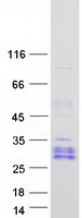 protq8iy57 yy1 associated factor 2 yaf2 human recombinant protein