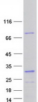 Coomassie blue staining of purified RAVER1 protein
