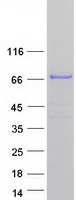 Coomassie blue staining of purified EXOC8 protein