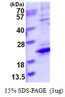 3ug by SDS-PAGE under reducing condition and visualized by coomassie blue stain.
