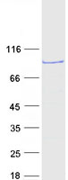 protq8iyr2 smyd4 human recombinant protein