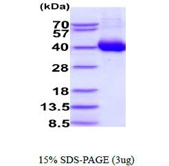 3ug by SDS-PAGE under reducing condition and visualized by coomassie blue stain.