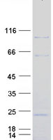 protq8iyy4 dzip1l human recombinant protein