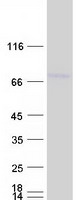 protq8izd4 dcp1b human recombinant protein