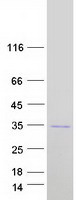 Coomassie blue staining of purified SYCP3 protein
