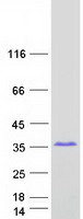 Coomassie blue staining of purified SPAG16 protein