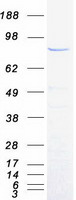 protq8n0x7 spart human recombinant protein
