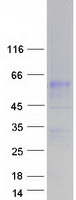 protq8n130 slc34a3 human recombinant protein