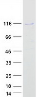 Coomassie blue staining of purified SIX5 protein