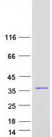 protq8n1q1 ca13 human recombinant protein