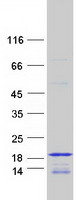 Coomassie blue staining of purified HIST3H2BB protein