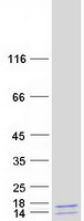 protq8n2z9 mhf1 cenps human recombinant protein