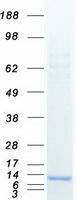 Coomassie blue staining of purified SVBP protein