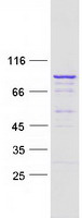 protq8n309 lrrc43 human recombinant protein
