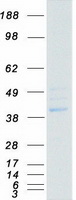 protq8n3j5 ppm1k human recombinant protein