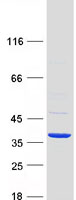 protq8n3y7 rdhe2 sdr16c5 human recombinant protein