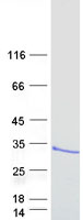 Coomassie blue staining of purified ARL14 protein