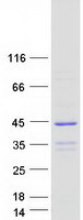 Coomassie blue staining of purified CRACR2B protein