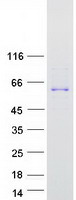 Coomassie blue staining of purified TTC39C protein