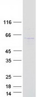 Coomassie blue staining of purified MPND protein