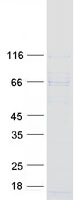 Coomassie blue staining of purified WDTC1 protein