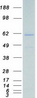 Coomassie blue staining of purified CAMKK1 protein