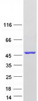 Coomassie blue staining of purified AADAT protein