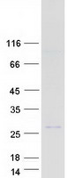 Coomassie blue staining of purified DEFB125 protein