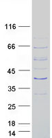 protq8n6g2 c13orf26 tex26 human recombinant protein