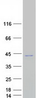 Coomassie blue staining of purified OTUD6B protein