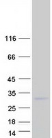 Coomassie blue staining of purified C1orf52 protein