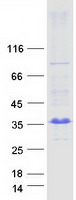 protq8n8l6 arl10 human recombinant protein