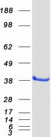 Coomassie blue staining of purified PTGR2 protein