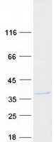 Coomassie blue staining of purified ARL14EP protein