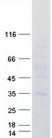 protq8n8u3 march3 human recombinant protein
