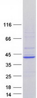 Coomassie blue staining of purified ATP6V0D2 protein