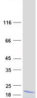protq8n9a8 tmem188 cnep1r1 human recombinant protein