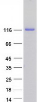 protq8n9b5 jmy human recombinant protein