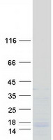 Coomassie blue staining of purified SREK1IP1 protein
