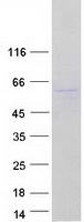 Coomassie blue staining of purified TC2N protein